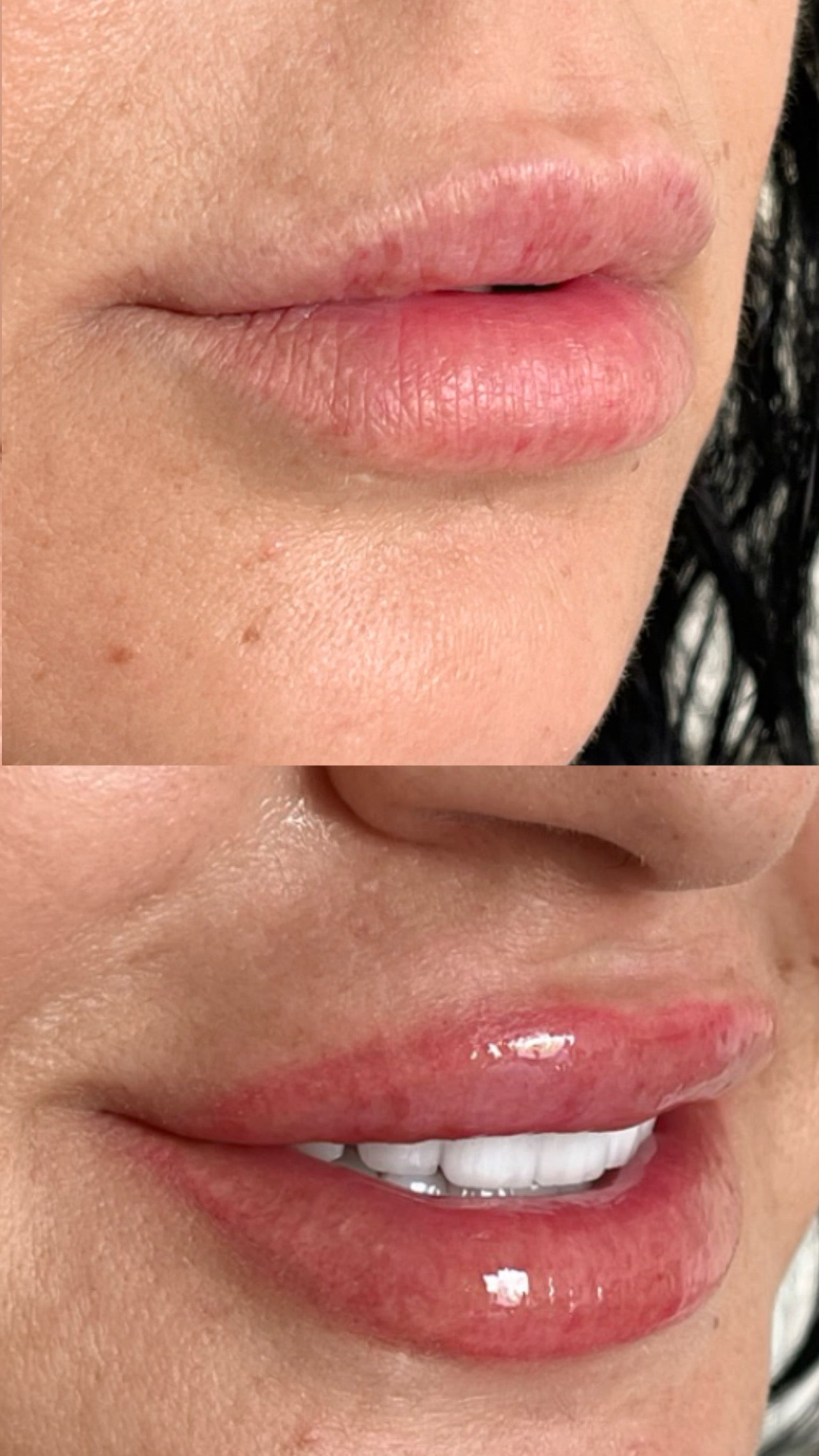 SPIES IT UP PLUMPER KIT